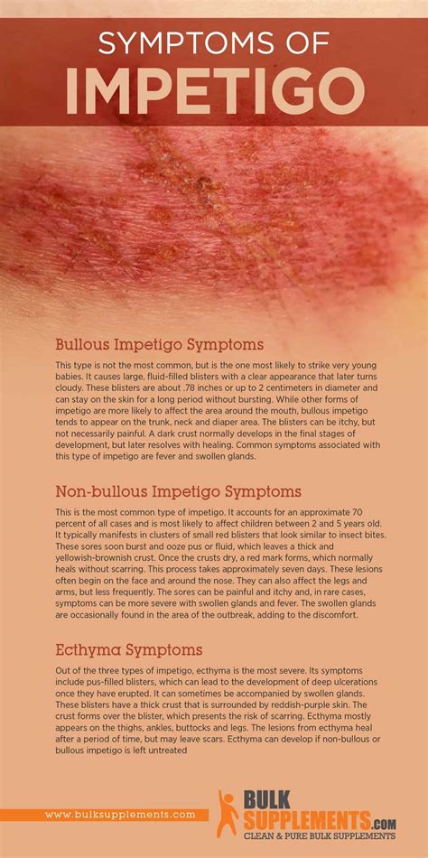 Impetigo Symptoms Causes Treatment By James Denlinger