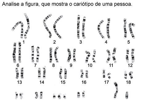 A Cariotipagem é Um Método Que Analisa