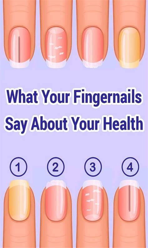 Pin By Dariush Heydarinya On Health Tips Nail Symptoms Fingernails
