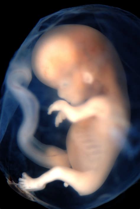 Эмбрион Человека Фото Telegraph