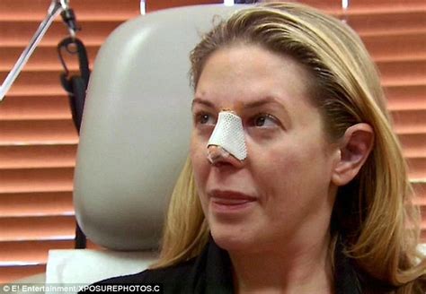 Texan Woman Was Pressurised By He Mother Into Having A Nose Job At 16