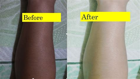 How To Lighten Face And Body Skin Color In 5 Daysmagical Skin Whitener