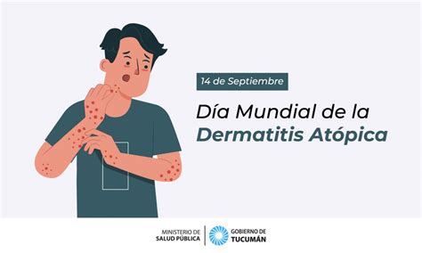 D A Mundial De La Dermatitis At Pica Ministerio De Salud P Blica De