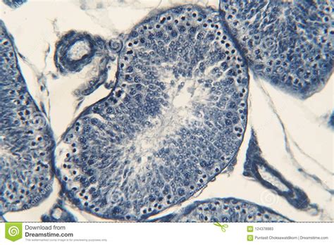 human testis under microscope view stock image image of bladder epididymis 124378983