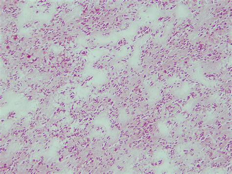 Pseudomonas Aeruginosa Gram Stain Gram Stain Of Pure Cultu Flickr