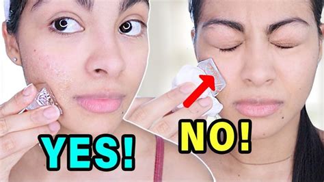 Right Way Of Rubbing Ice Cubes On Your Face Step By Step Acne Hacks Organic Skin Care
