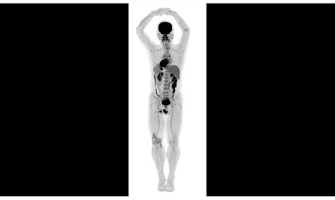 Human Images From Worlds First Total Body Scanner Unveiled