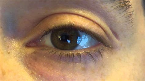 In reality, however, this feature sucks. Left eye color change - YouTube
