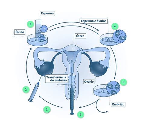 Fertilização in vitro FIV