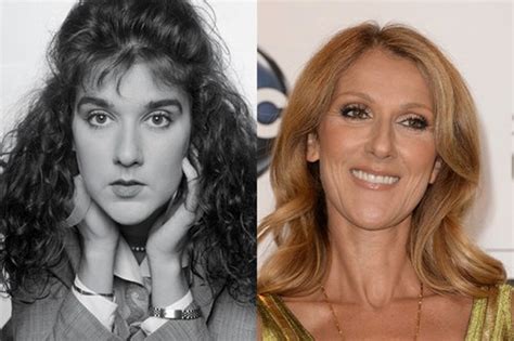 Celine Dion Nose Job Plastic Surgery Before And After Celebie