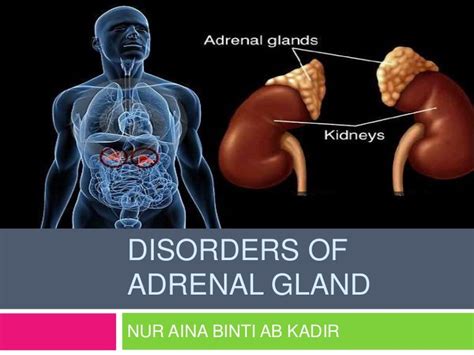 Disorders Of Adrenal Gland