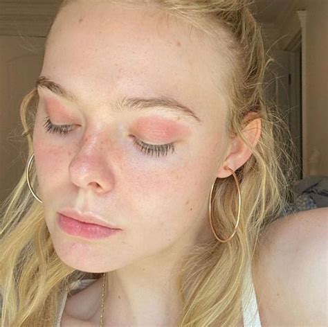 Elle Fanning Shares Photos Of Eczema Outbreak On Eyelids