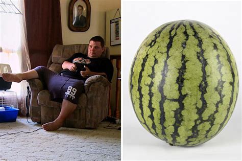 Video Of Man With One Stone Scrotum Bigger Than A Watermelon Daily Star