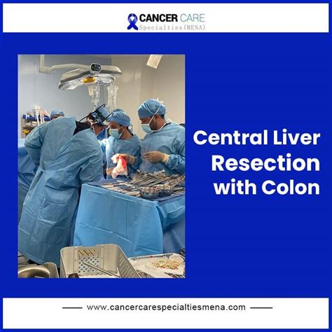 Central Liver Resection With Colon Cancer Care Center Uae