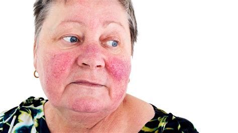 What Causes Redness And Itching On Face