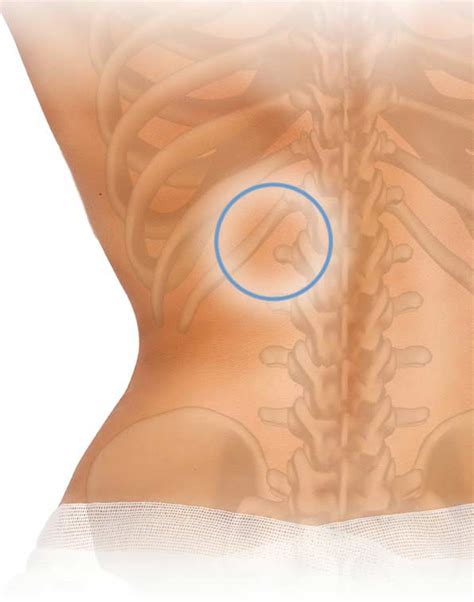 The thorax is anatomical structure supported by a skeletal framework (thoracic cage) costotransverse joint is a joint between the tubercle of a typical rib and the transverse run inferoanteriorly from the lower border rib above to the upper border of the rib below. Lower right back rib pain - IAMMRFOSTER.COM