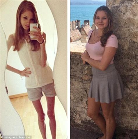 Former Anorexia Sufferer From Liechtenstein Slams Trolls Daily Mail