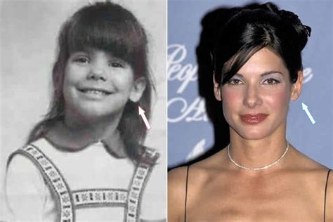 Has Sandra Bullock Had Plastic Surgery Before And After Photos