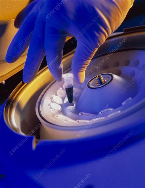 Hand Loading A Blood Sample Into A Centrifuge Stock Image M5300364