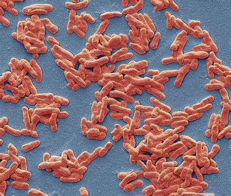 Mycobacterium Leprae Sem Stock Image C0213230 Science Photo Library