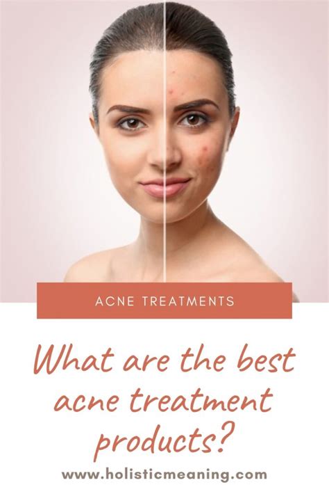 What Are The Best Acne Treatment Products Holistic Meaning