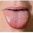 Human Tongue  Stock Image C022/0661 Science Photo Library