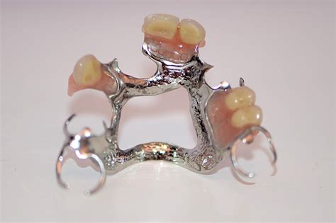 The custom made partial denture will remain firmly in place. Dentures - Wakefield Dental Care