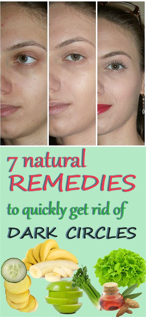 7 Natural Remedies To Get Rid Of Dark Circles Dark Circles Natural Remedies