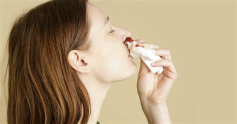 Krwawienie z nosa w ciąży przyczyny jak zatamować krew z nosa Dziecko