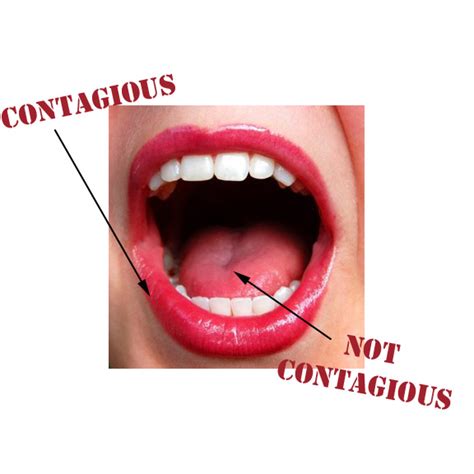 Sexual contact is the primary way that the virus spreads. Irritation Inside Mouth - Transexual You Porn