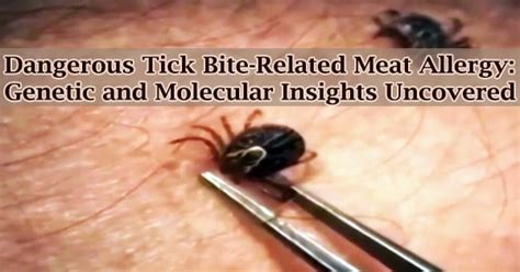 Dangerous Tick Bite Related Meat Allergy Genetic And Molecular