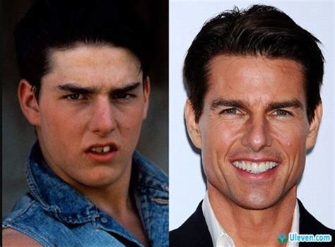 Top Male Celebrities You Didn T Know Had Plastic Surgery Part