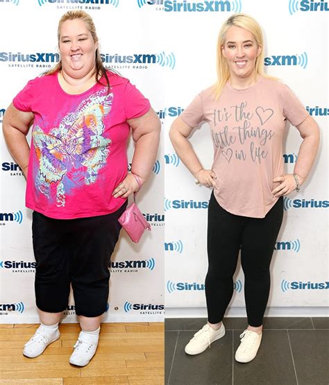 Mama June From Before And After Celebs Who Have Admitted To Weight Loss Surgery