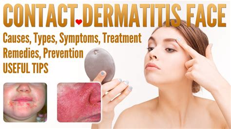 Contact Dermatitis Face Causes Types Symptoms Treatment Prevention