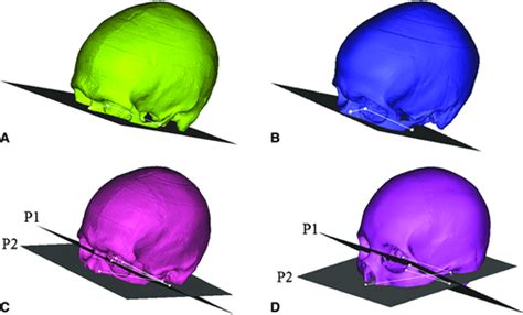 Evaluation Of Morphological Changes In The Adult Skull With Age And Sex