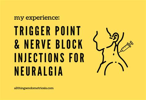 Glossopharyngeal Neuralgia Occipital Neuralgia Trigger Points