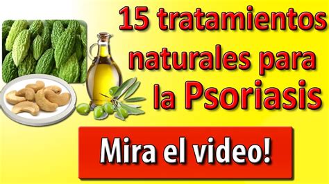 Psoriasis Tratamiento 15 Tratamientos Para La Psoriasis Parte I Youtube