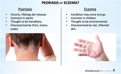 Psoriasis Vs Eczema The Difference Dorothee Padraig South West Skin