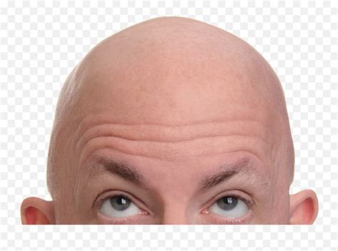 Bald Bold Hair Png Emojibald Emoji Free Transparent Emoji