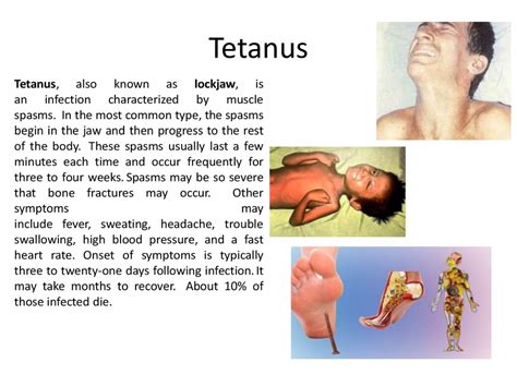 Gas gangrene (also known as clostridial myonecrosis and myonecrosis) is a bacterial infection that produces tissue gas in gangrene. Clostridium perfringens - презентация онлайн