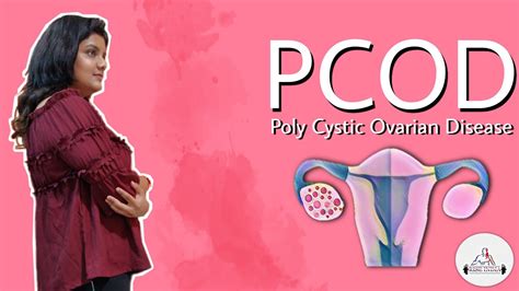 Poly Cystic Ovarian Disease And Syndrome Causes Symptoms And Treatment