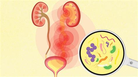 What Is A Urinary Tract Infection Uti Symptoms Causes Diagnosis