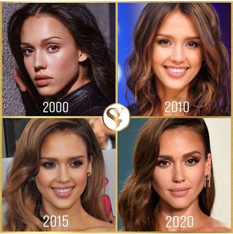 Cosmetic Injectables 🇬🇧 On Instagram “jessica Albas Transformation Shes Hardly Aged 😍😍 She