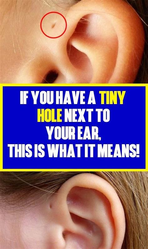 You'll need to have a consultation with an. Did You Ever Wonder What This Tiny Hole Next To Your Ear ...