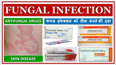 Fungal Infection फंगल इंफेक्शन को ठीक करने की दवा Antifungal Drugs