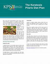 Pictures of Doctors Diet Plan