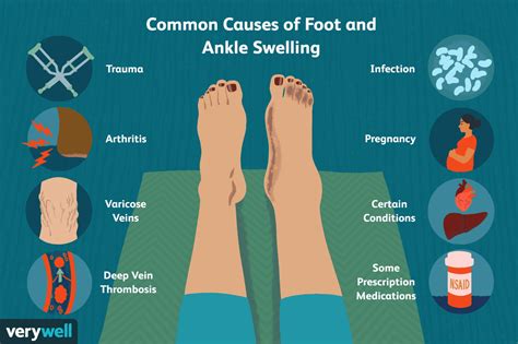 common causes of foot and ankle swelling