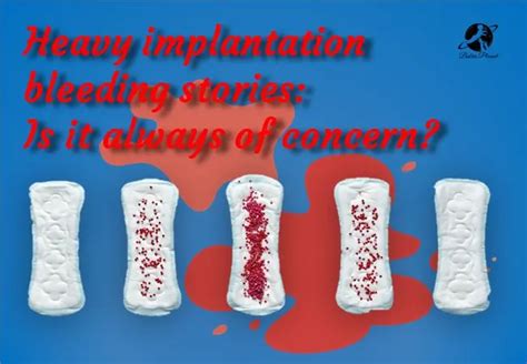 Heavy Implantation Bleeding Stories And Pictures Babiesplannet
