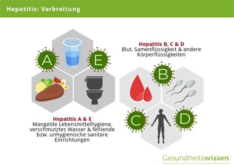 Viral hepatitis b and c: Hepatitis - Ursachen, Symptome, Diagnose & Behandlung