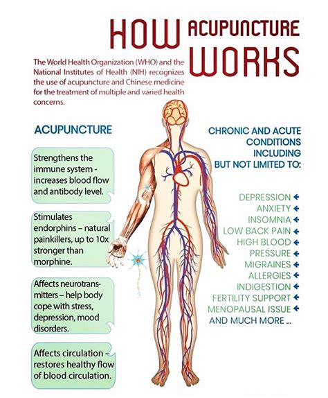 How Acupuncture Works